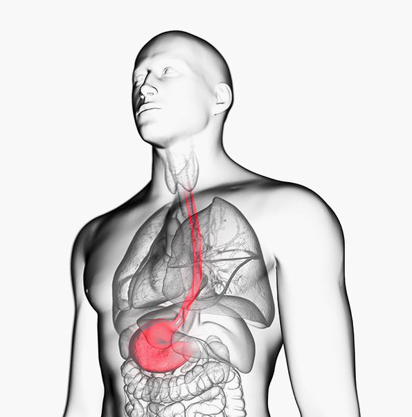 위·식도 질환